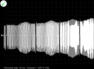 Amplitude and frequency of pulses generated by an inductive sensor