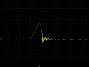 Piezo sensor injection pulse zoomed