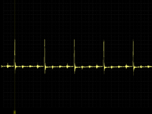 PD4/PD6 injection pulses waveform