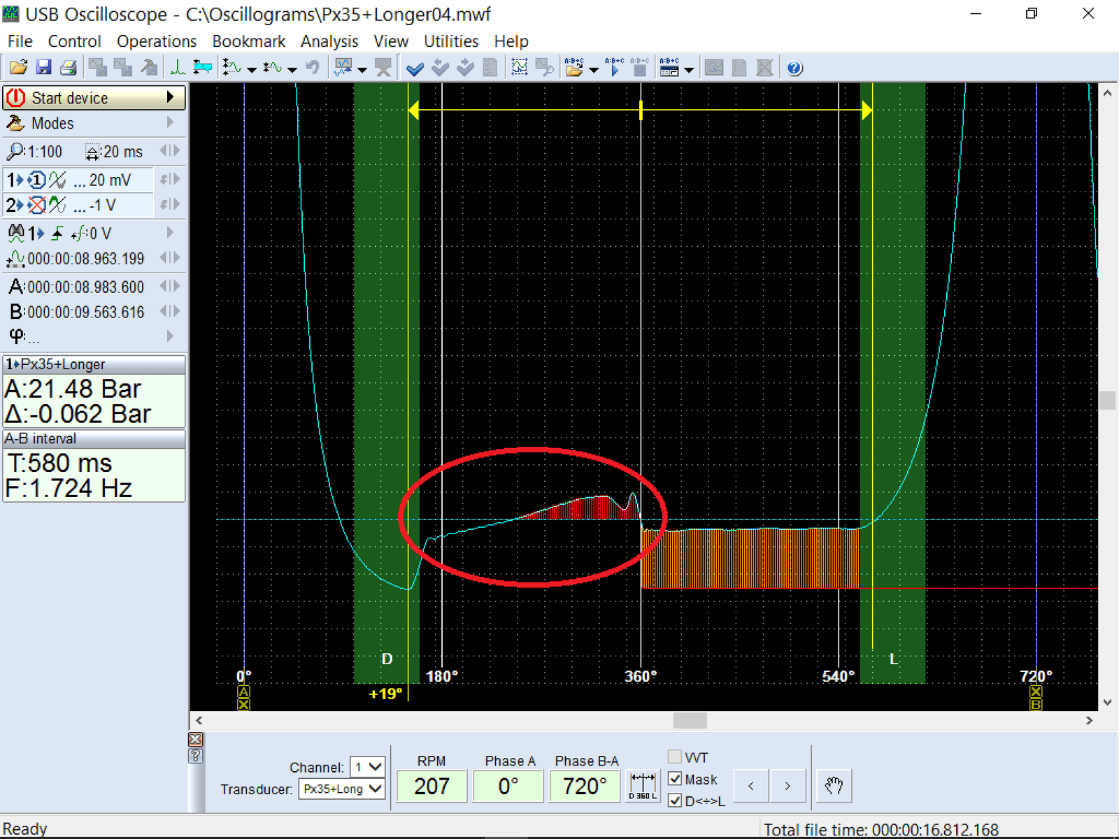 Pressure waveform showing an anomaly