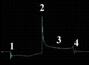 Secondary waveform of the serviceable rod individual ignition coil