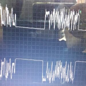 Mercedes-Benz Actros 460 distorted CAN waveform captured with USB Autoscope IV